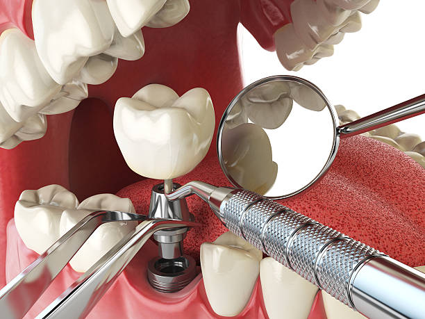 Best Cracked Tooth Emergency Dentist  in Conrad, MT